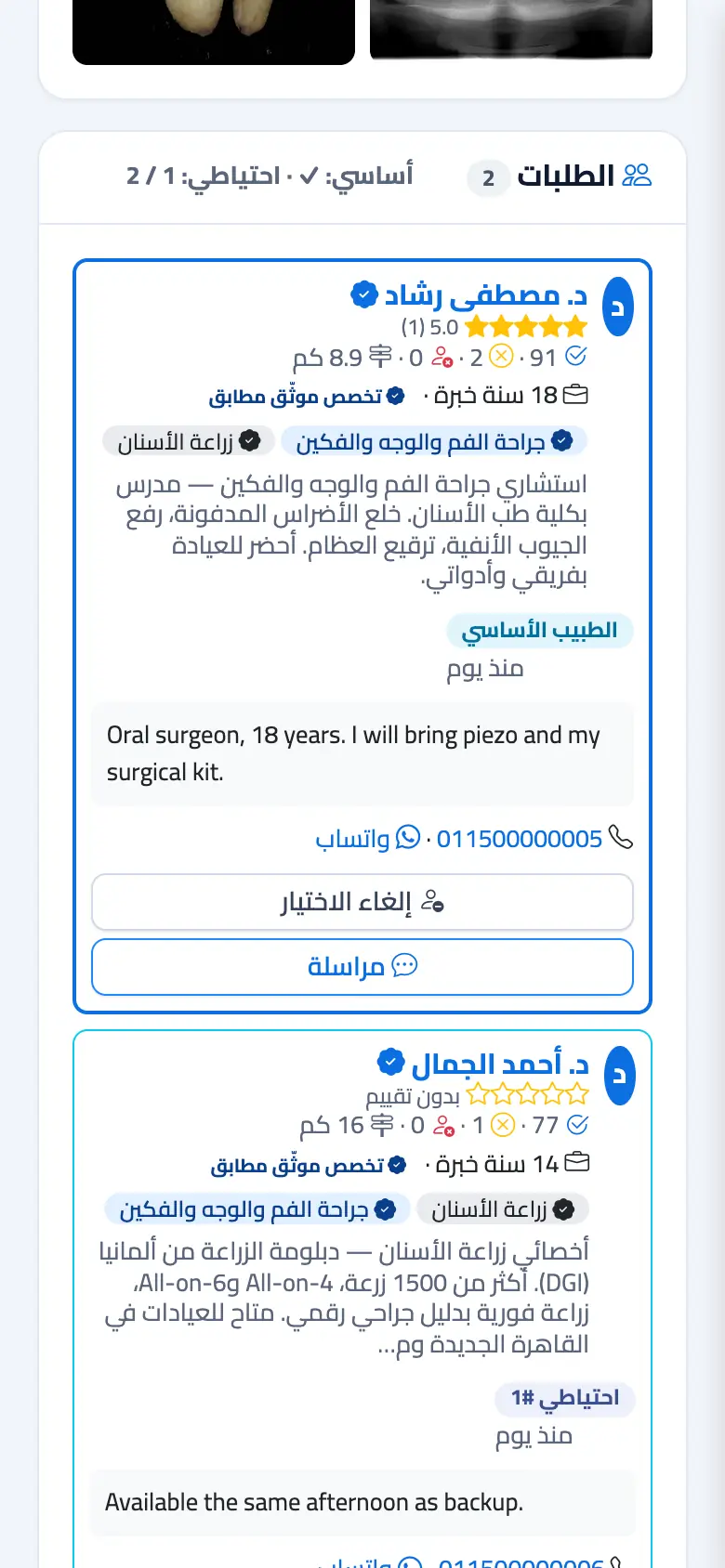 بعد التعيين